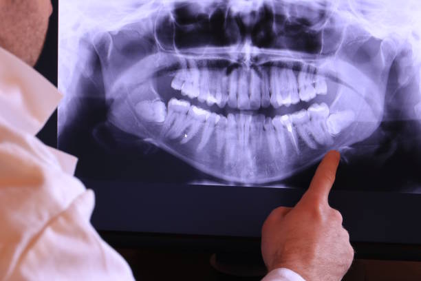Best After-Hours Emergency Dentist in Lake Dallas, TX